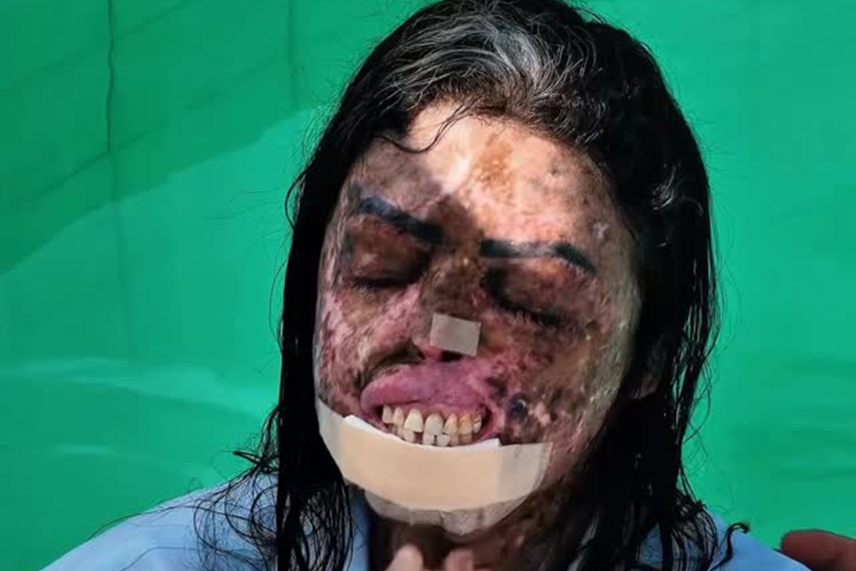 quem-foi-karine-felipe,-influencer-que-lutou-contra-cancer-terminal