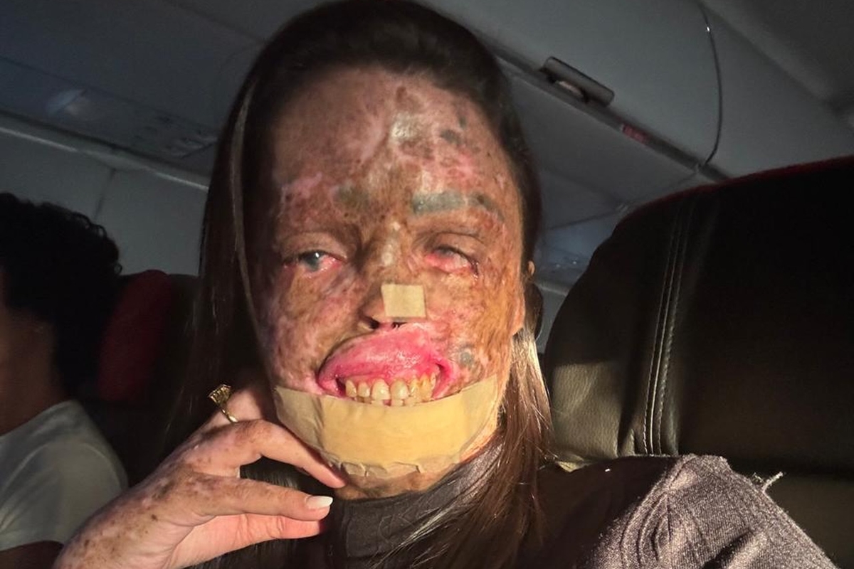 morre-karine-felipe,-influencer-que-lutava-contra-doenca-rara